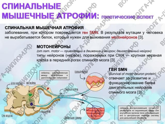 Современное состояние вопроса в создании препаратов для лечения спинальной мышечной атрофии Современное состояние вопроса в создании препаратов для лечения спинальной мышечной атрофии